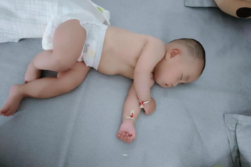 广水孕妇肚脐周围发青